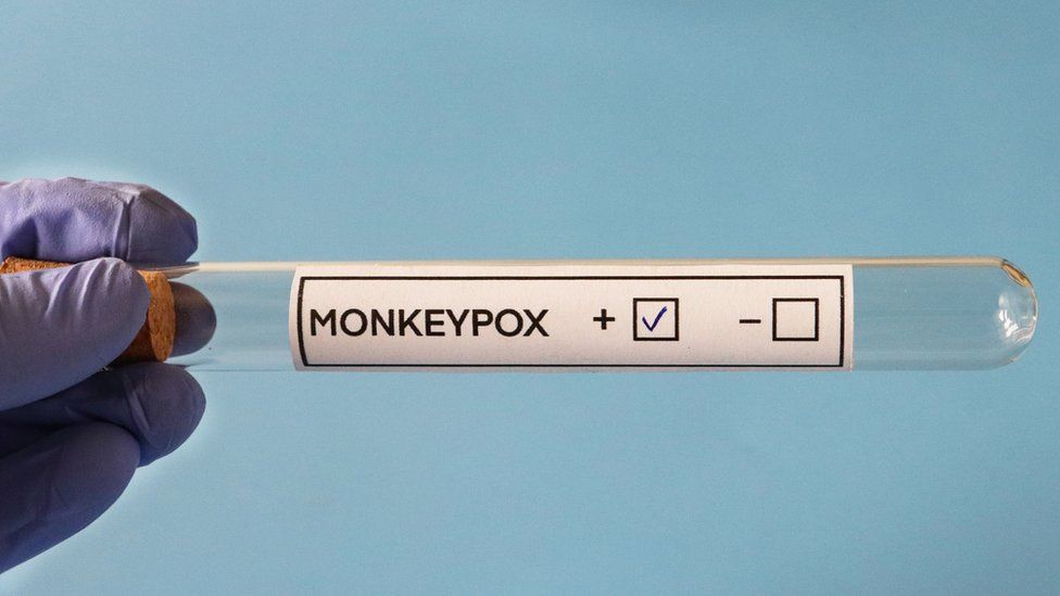 More than 300 monkeypox cases now found in UK