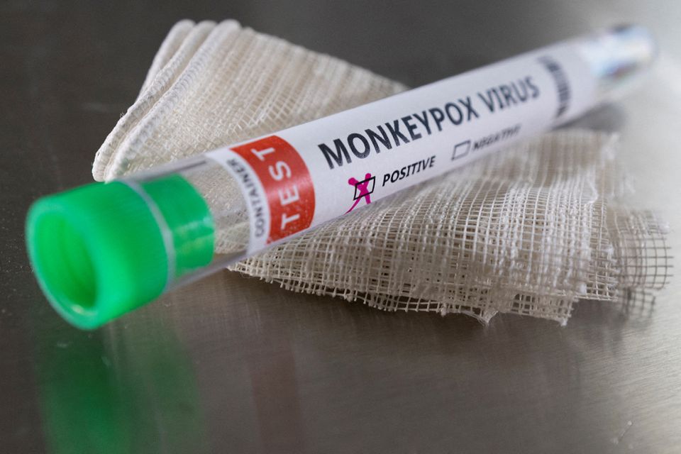 Health agency confirms community spread of monkeypox in England