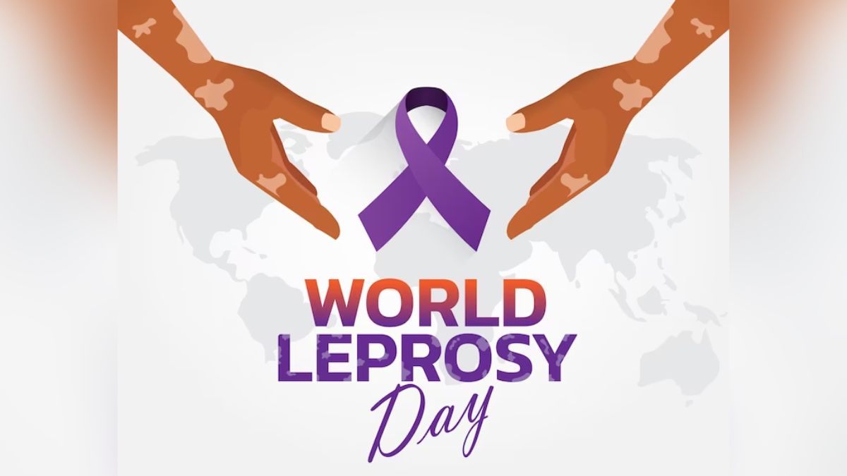 World Leprosy Day being observed today